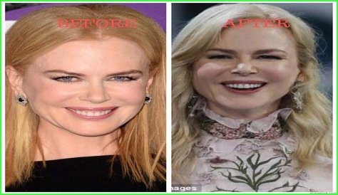 Nicole Kidman's 